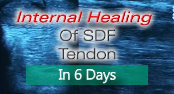VET Sonotron Mark2 Produces Rapid Internal Healing Of SDF Tendon Tissues Of Racehorses